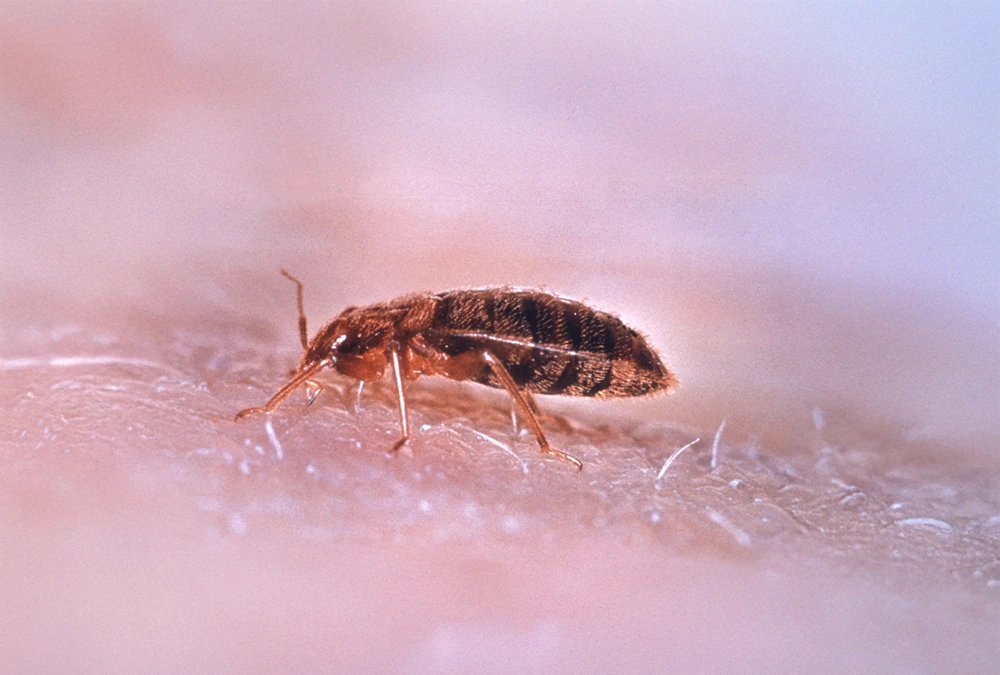 pecon-pro-bettwanzen-bekaempfung Bettwanze in Nahaufnahme auf der menschlichen Haut – Bettwanzenbekämpfung durch Pecon Pro Flein